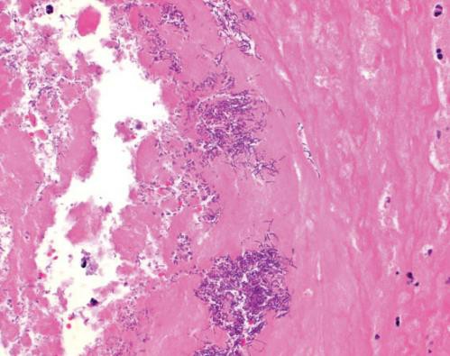 8-2-medical-device-pathology-evaluation-1